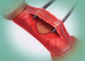 How to surgery to increase membership