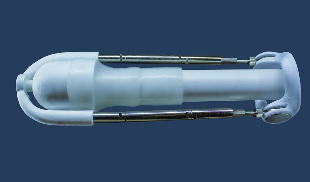 An extender is a device that helps extend the length of a man's penis.