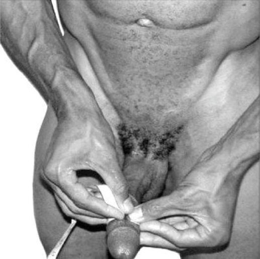 measure penis before enlargement